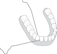 FLOSSING.CMX
