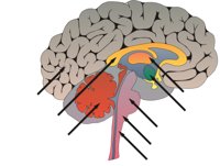 BRAIN02.CMX