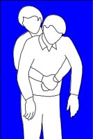 HEIMLICH.CMX