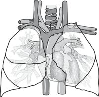 THORAXAN.CMX