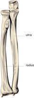 RADIUS.CMX