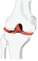 KNEECART.CMX