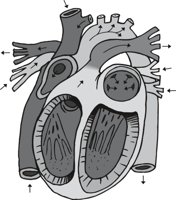 HEART_I.CMX