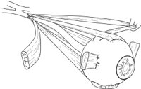 EXEYE.CMX