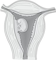 EMBRYO.CMX