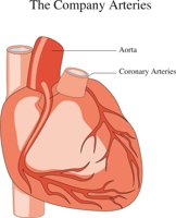 CORONARY.CMX