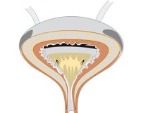 BLADDER.CMX