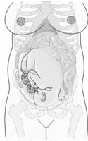BABYWOMB.CMX