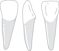 INCISOR.CMX