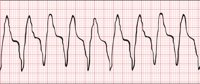 EKG3.CMX