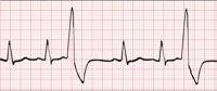 EKG2.CMX