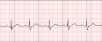 EKG1.CMX