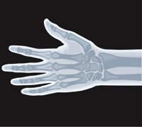 XRAYH.CMX