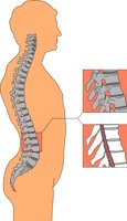 BONE017.CMX