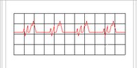 EKGCHART.WMF