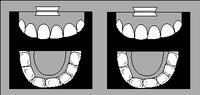 XRAY.WMF