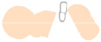 PD003ACW.PCT