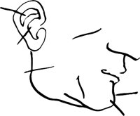 ACUPUNL.WMF