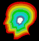 cat_scan_of_brain_mb.gif