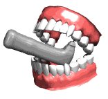 teeth2_drilling_lw.gif