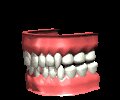 teeth1_chattering_mc.gif
