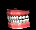 teeth1_chattering_lc.gif