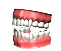 teeth1_chattering_hr.jpg