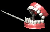 tartarteeth_cleaningg_a_mc.gif