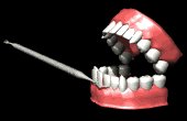 tartarteeth_cleaningg_a_mb.gif