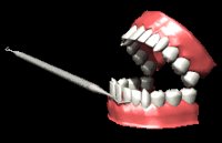 tartarteeth_cleaningg_a_lc.gif