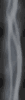 fog_side_mb.gif