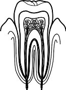 BKV00005.WMF