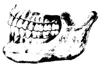 TEETH2S5.BMP
