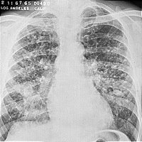 X_RAY.BMP