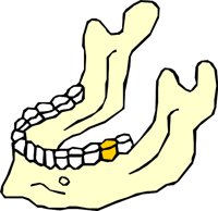 TEETH_14.WMF