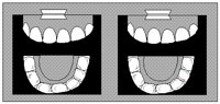 XRAY.BMP