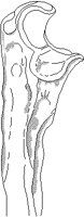 FEMUR.BMP